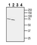 GPR143 Antibody in Western Blot (WB)