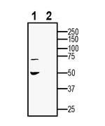 GPR143 Antibody in Western Blot (WB)