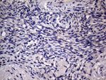 AGR2 Antibody in Immunohistochemistry (Paraffin) (IHC (P))