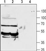 GABA Transporter 2 (GAT-2) Antibody in Western Blot (WB)