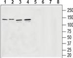 Vesicular GABA Transporter (VGAT) Antibody in Western Blot (WB)