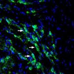 SLC6A14 (extracellular) Polyclonal Antibody