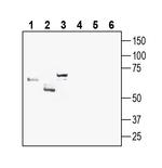 GLUT8 (extracellular) Polyclonal Antibody