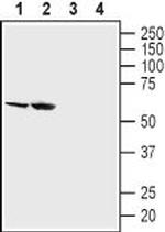 SGLT2 (extracellular) Polyclonal Antibody