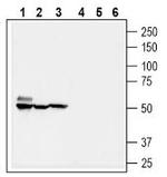 SMCT1 (SLC5A8) Antibody in Western Blot (WB)