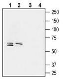 SMCT1 (SLC5A8) Antibody in Western Blot (WB)