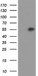 AGT Antibody in Western Blot (WB)