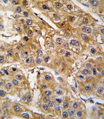 Angiotensinogen Antibody in Immunohistochemistry (IHC)