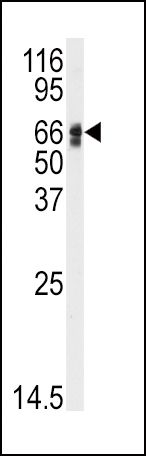 Angiotensinogen Antibody in Western Blot (WB)