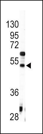 Angiotensinogen Antibody in Western Blot (WB)