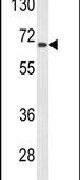 AGXT2 Antibody in Western Blot (WB)