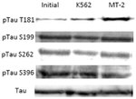 Tau Antibody in Western Blot (WB)