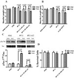 Tau Antibody in Western Blot (WB)