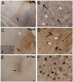 Tau Antibody in Immunohistochemistry (IHC)
