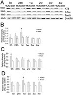 Tau Antibody in Western Blot (WB)