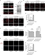 Tau Antibody in Immunocytochemistry (ICC/IF)
