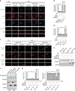 Tau Antibody in Immunocytochemistry (ICC/IF)