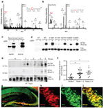 Tau Antibody in Western Blot, Immunoprecipitation (WB, IP)