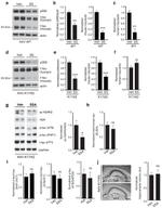 Tau Antibody in Western Blot (WB)