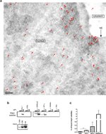 Tau Antibody in Immunomicroscopy (IM)