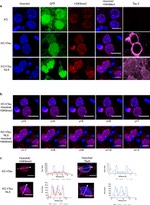 Tau Antibody in Immunocytochemistry (ICC/IF)