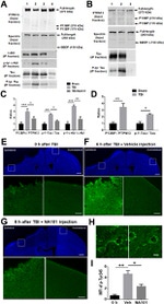 Tau Antibody in Western Blot (WB)
