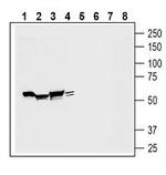 OTOP1 Antibody in Western Blot (WB)