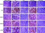 IL-8 (CXCL8) Antibody in Immunohistochemistry, Immunocytochemistry (IHC, ICC/IF)