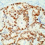 p53 Antibody in Immunohistochemistry (Paraffin) (IHC (P))