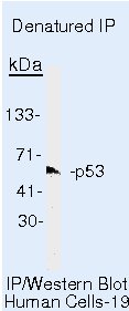 p53 Antibody in Immunoprecipitation (IP)