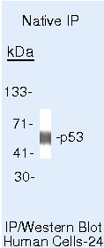 p53 Antibody in Immunoprecipitation (IP)