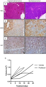 ErbB2 (HER-2) Antibody in Immunohistochemistry (IHC)