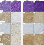 ErbB2 (HER-2) Antibody in Immunohistochemistry (IHC)