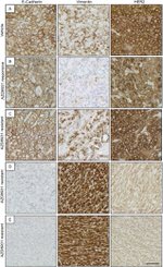 ErbB2 (HER-2) Antibody in Immunohistochemistry (IHC)