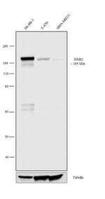 ErbB2 (HER-2) Antibody