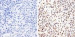 AKT1 Monoclonal Antibody (9Q7)
