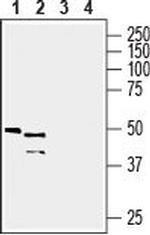GPR81/HCAR1 Antibody in Western Blot (WB)