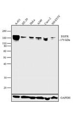 EGFR Antibody in Western Blot (WB)