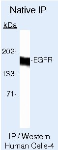 EGFR Antibody in Immunoprecipitation (IP)