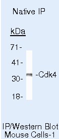 CDK4 Antibody in Immunoprecipitation (IP)
