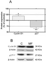 p27 Kip1 Antibody in Western Blot (WB)