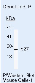 p27 Kip1 Antibody in Immunoprecipitation (IP)