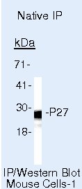 p27 Kip1 Antibody in Immunoprecipitation (IP)