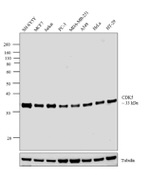 CDK5 Antibody in Western Blot (WB)
