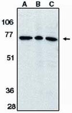 AIF Antibody in Western Blot (WB)
