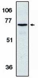 AIF Antibody in Western Blot (WB)