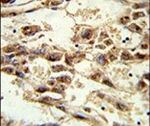 AMID Antibody in Immunohistochemistry (IHC)