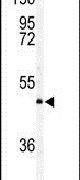 AMID Antibody in Western Blot (WB)