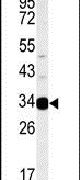 AIG1 Antibody in Western Blot (WB)