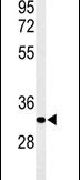AIG1 Antibody in Western Blot (WB)